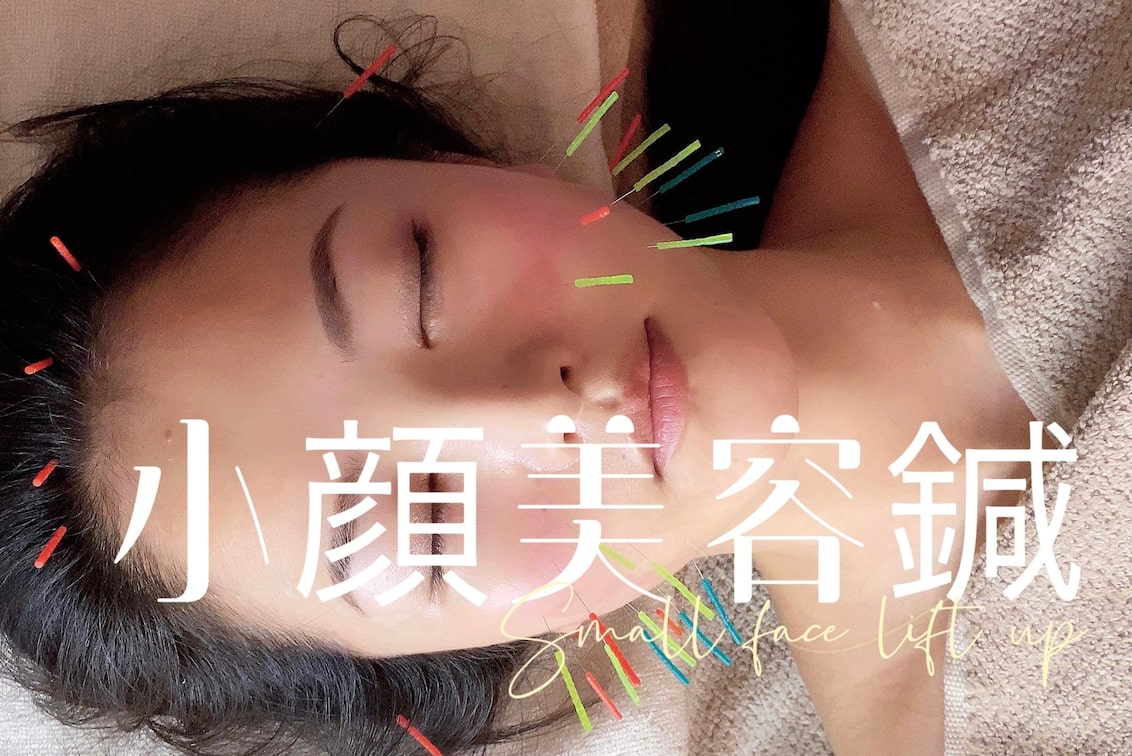 株式会社 PHOENIX(TIARABO小顔美容鍼)