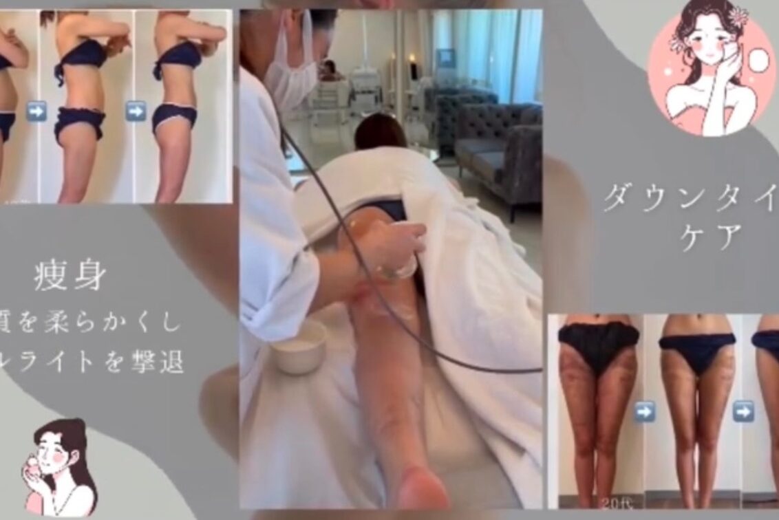 indiba salon miru(indiba salon miru)