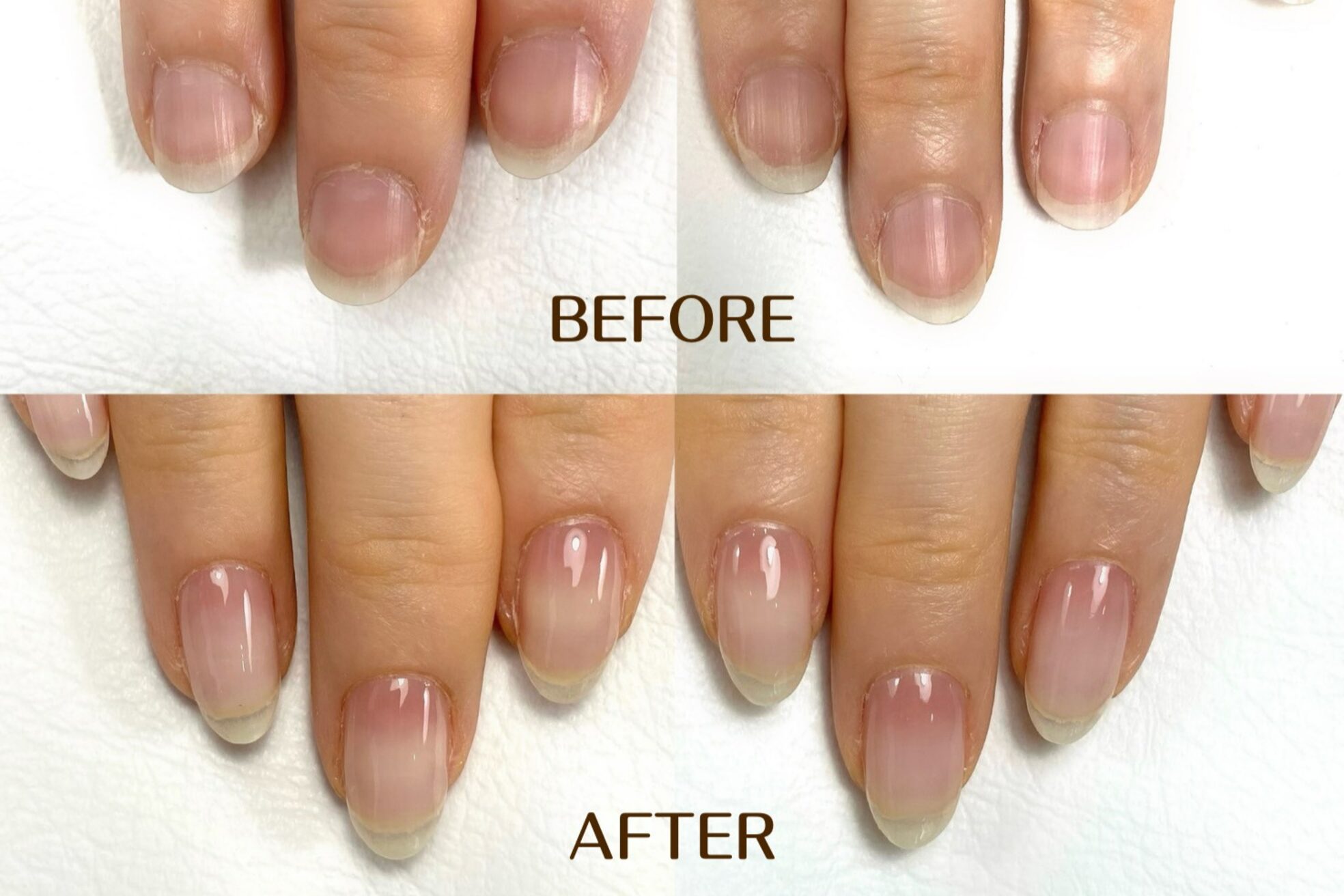 ネイル アンチュプラス(Nail Anchu+)5