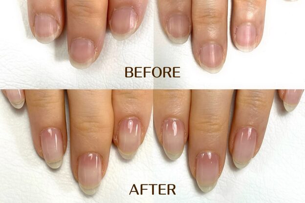ネイル アンチュプラス(Nail Anchu+)5