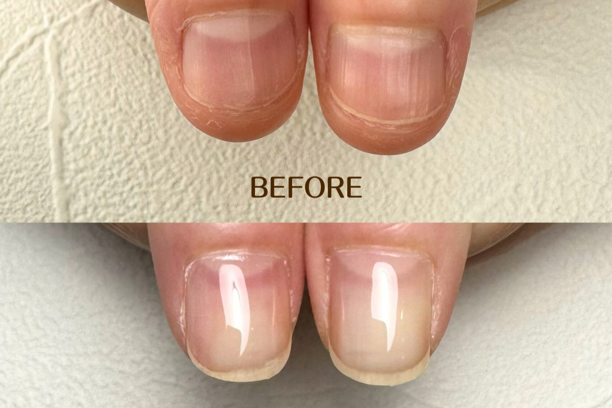 ネイル アンチュプラス(Nail Anchu+)7