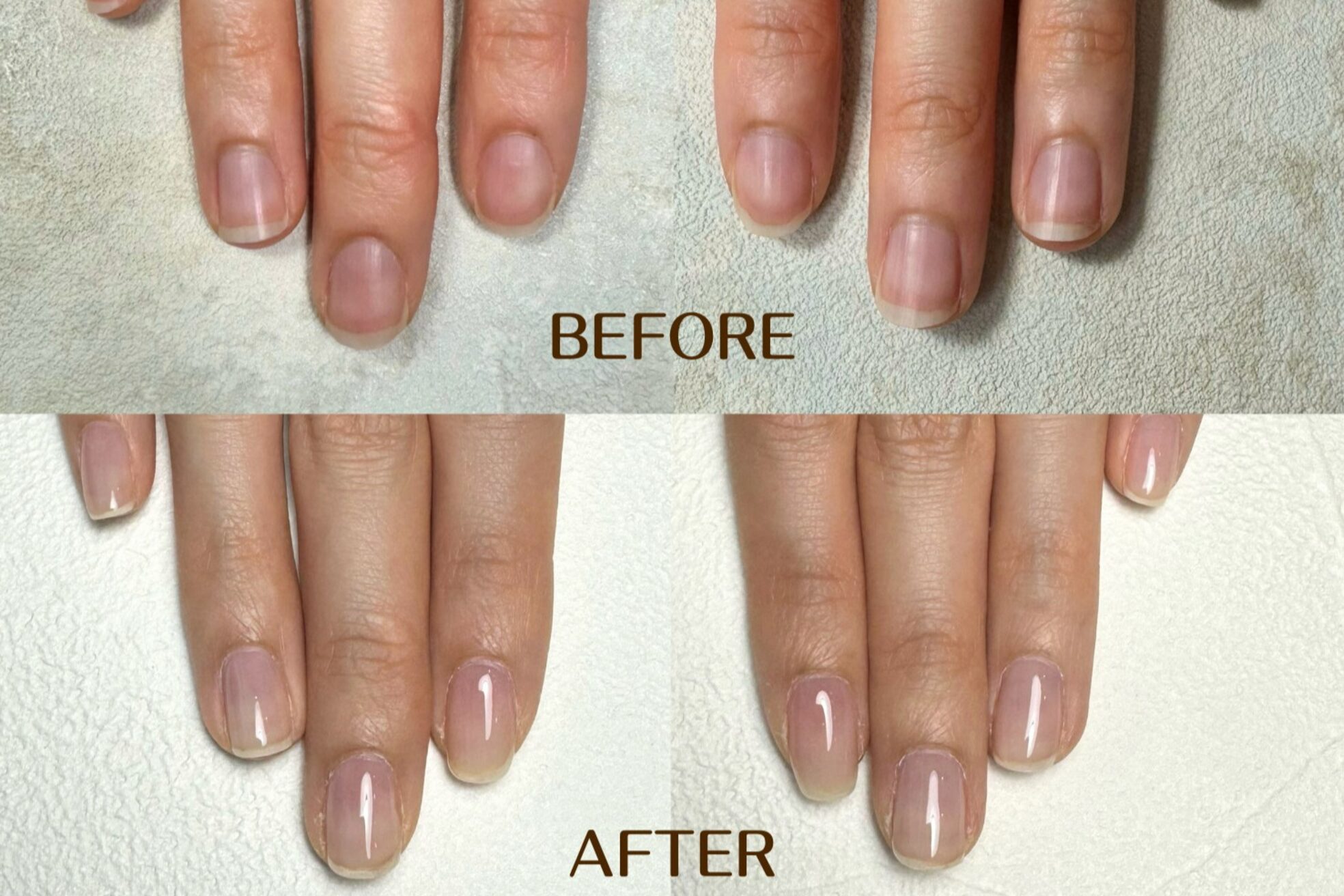 ネイル アンチュプラス(Nail Anchu+)6