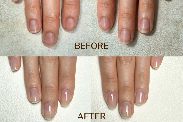 ネイル アンチュプラス(Nail Anchu+)6