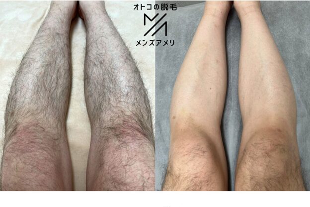 メンズアメリ29