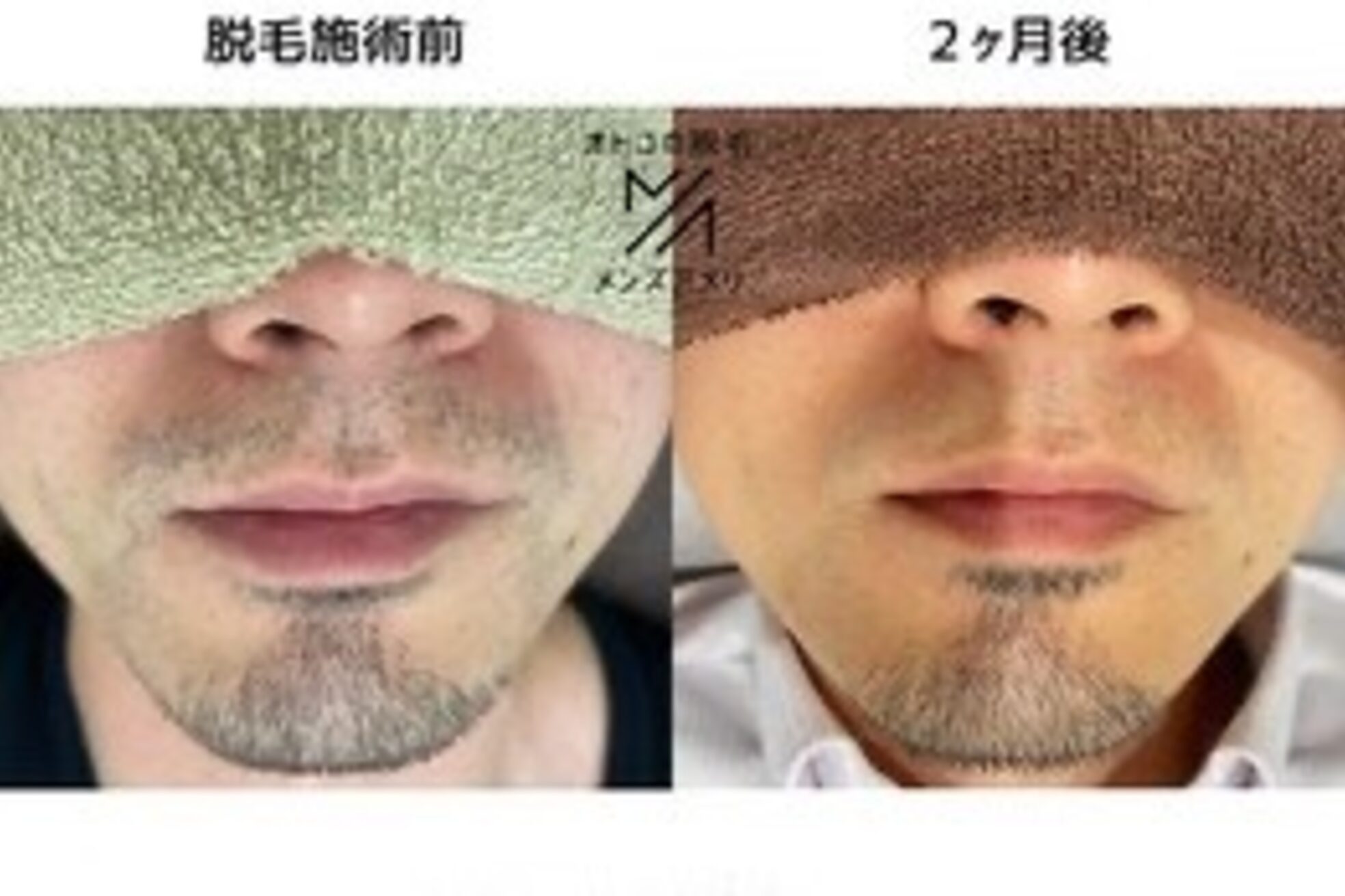 メンズアメリ13