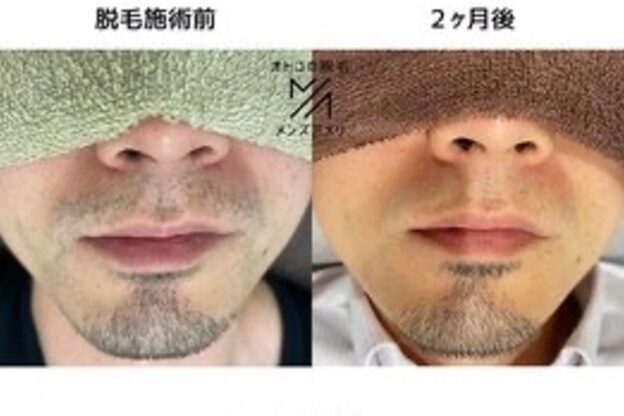 メンズアメリ13