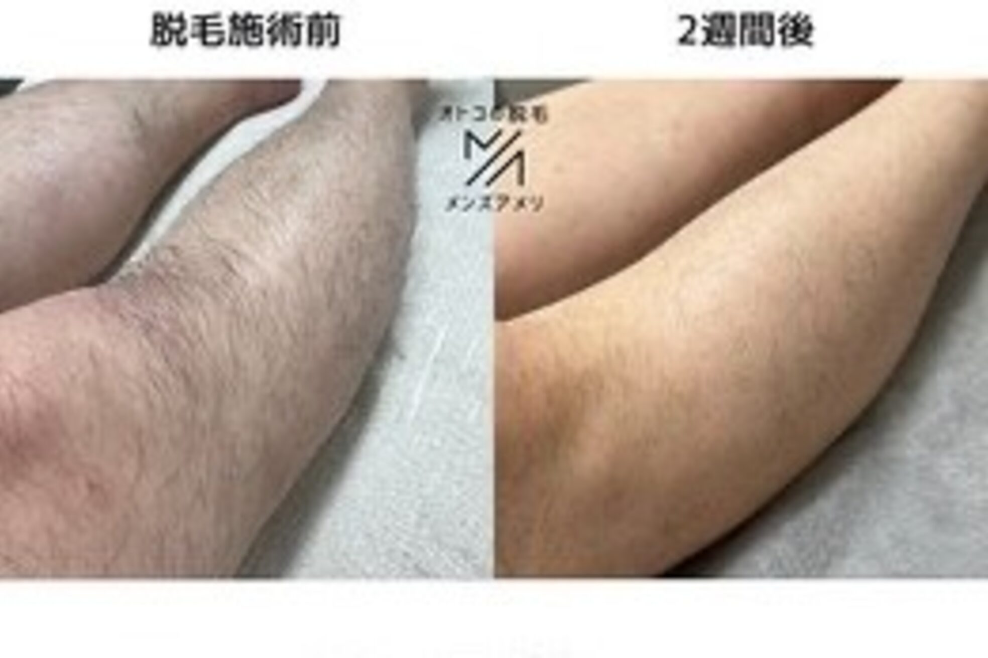 メンズアメリ12