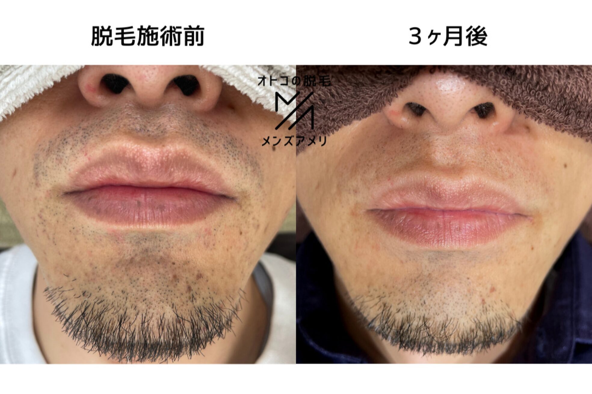 メンズアメリ30