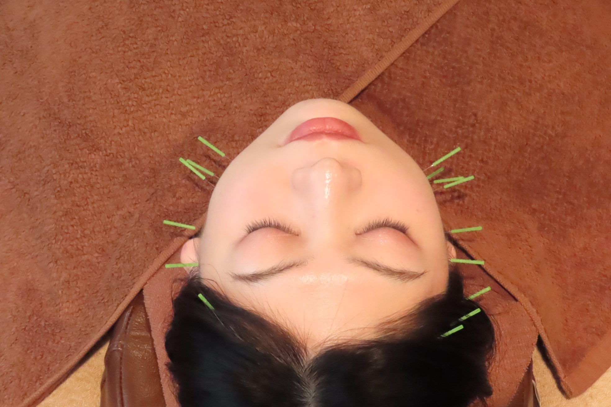 きわみ鍼灸整骨院 博多院9