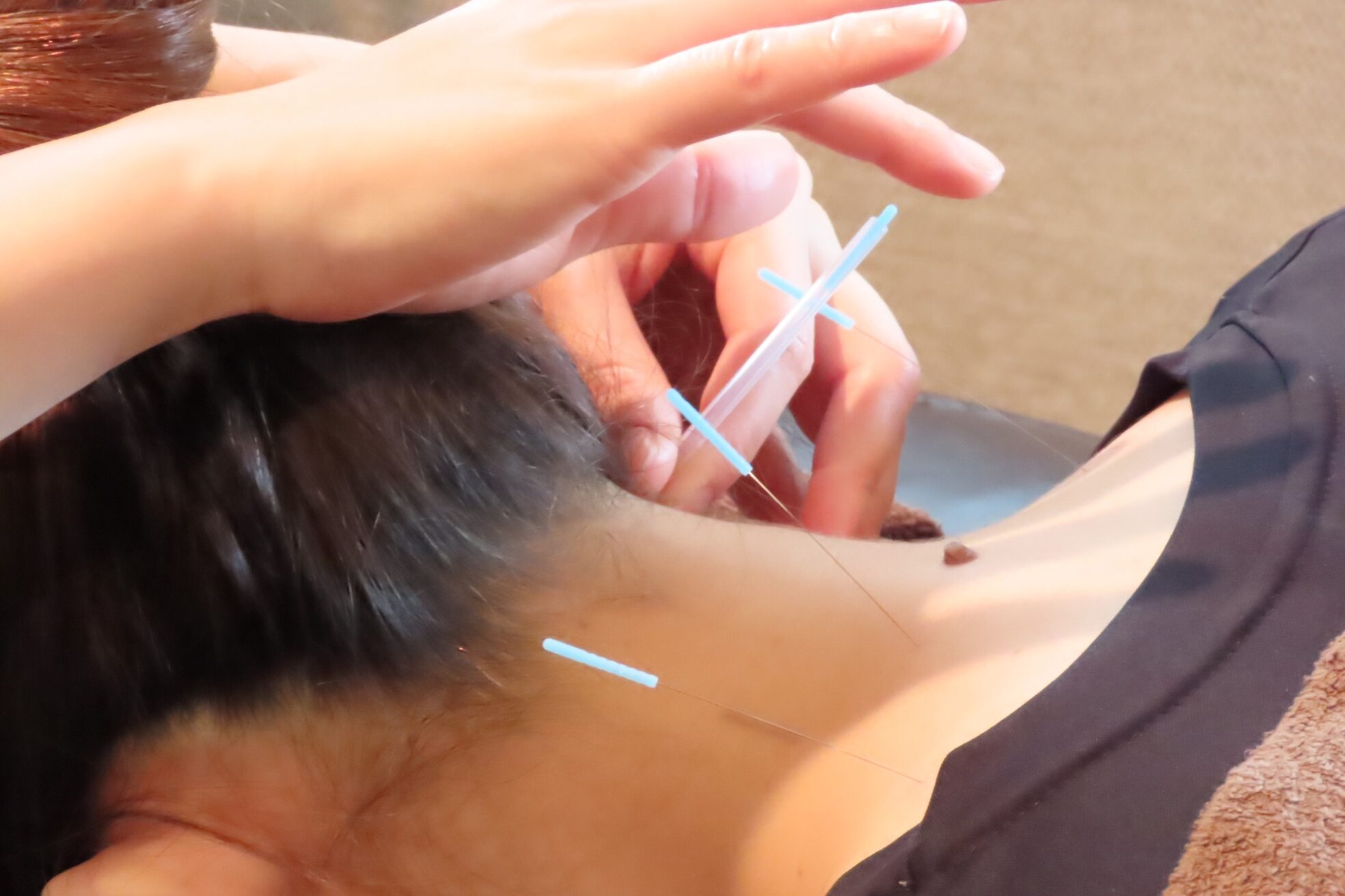 きわみ鍼灸整骨院 博多院2