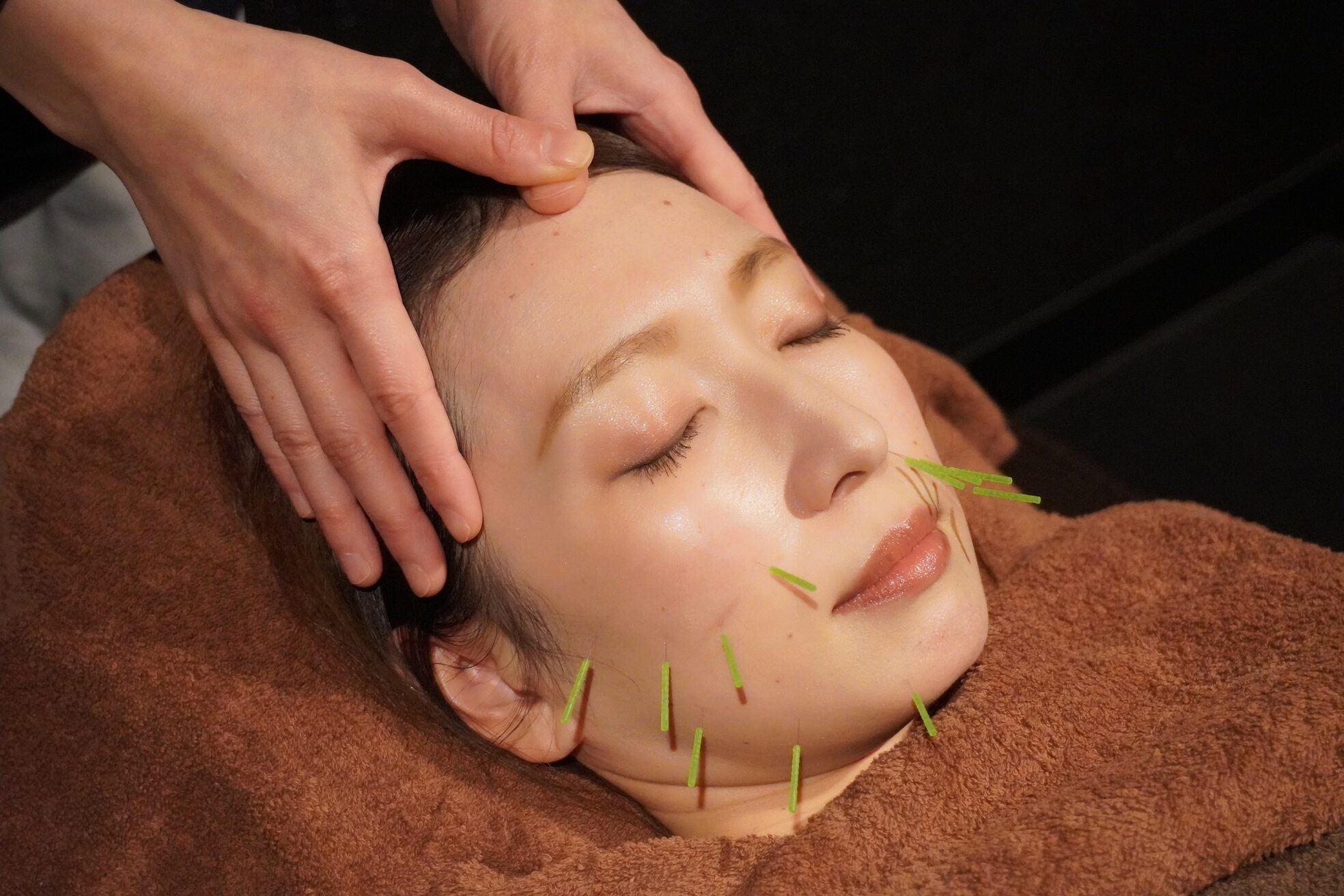 リバイブエス(Revive-S)10