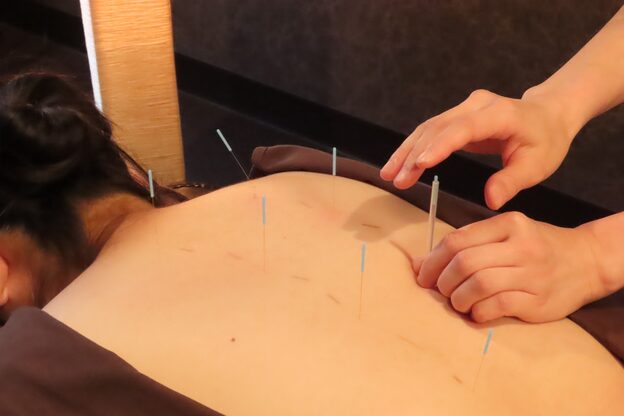 きわみ鍼灸整骨院 博多院4