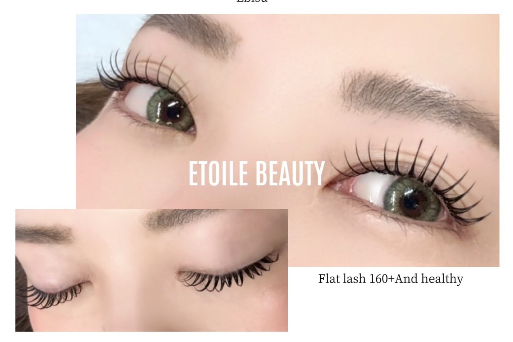 エトワールビューティー(ETOILE BEAUTY)4