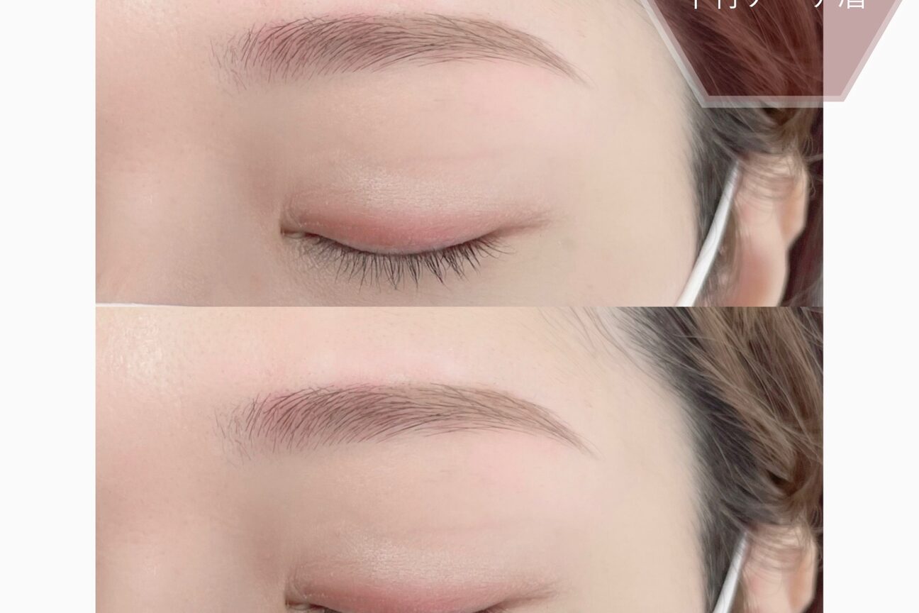 トリトン(triton)2