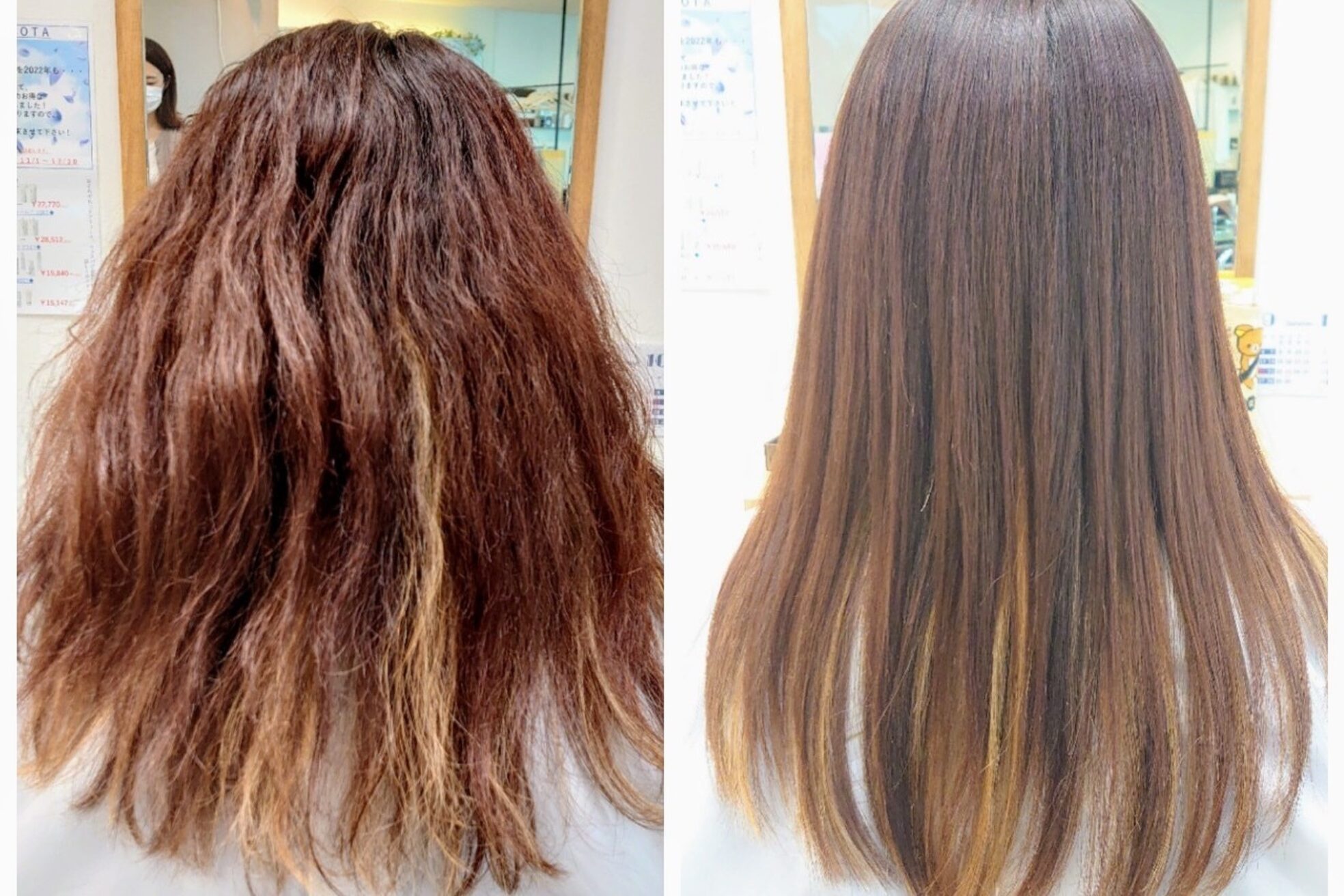 アンカー(ANCHOR)3