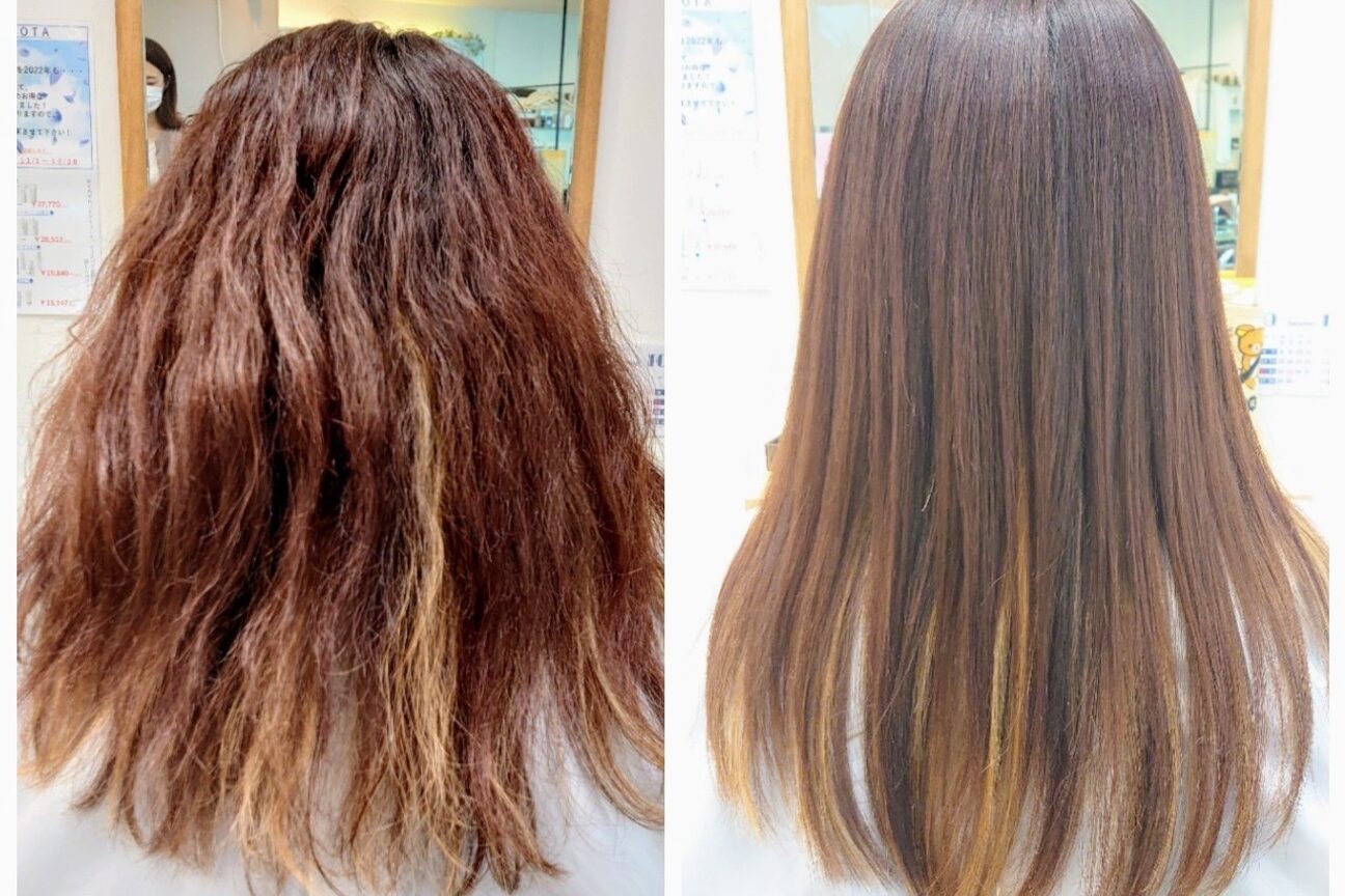 アンカー(ANCHOR)3