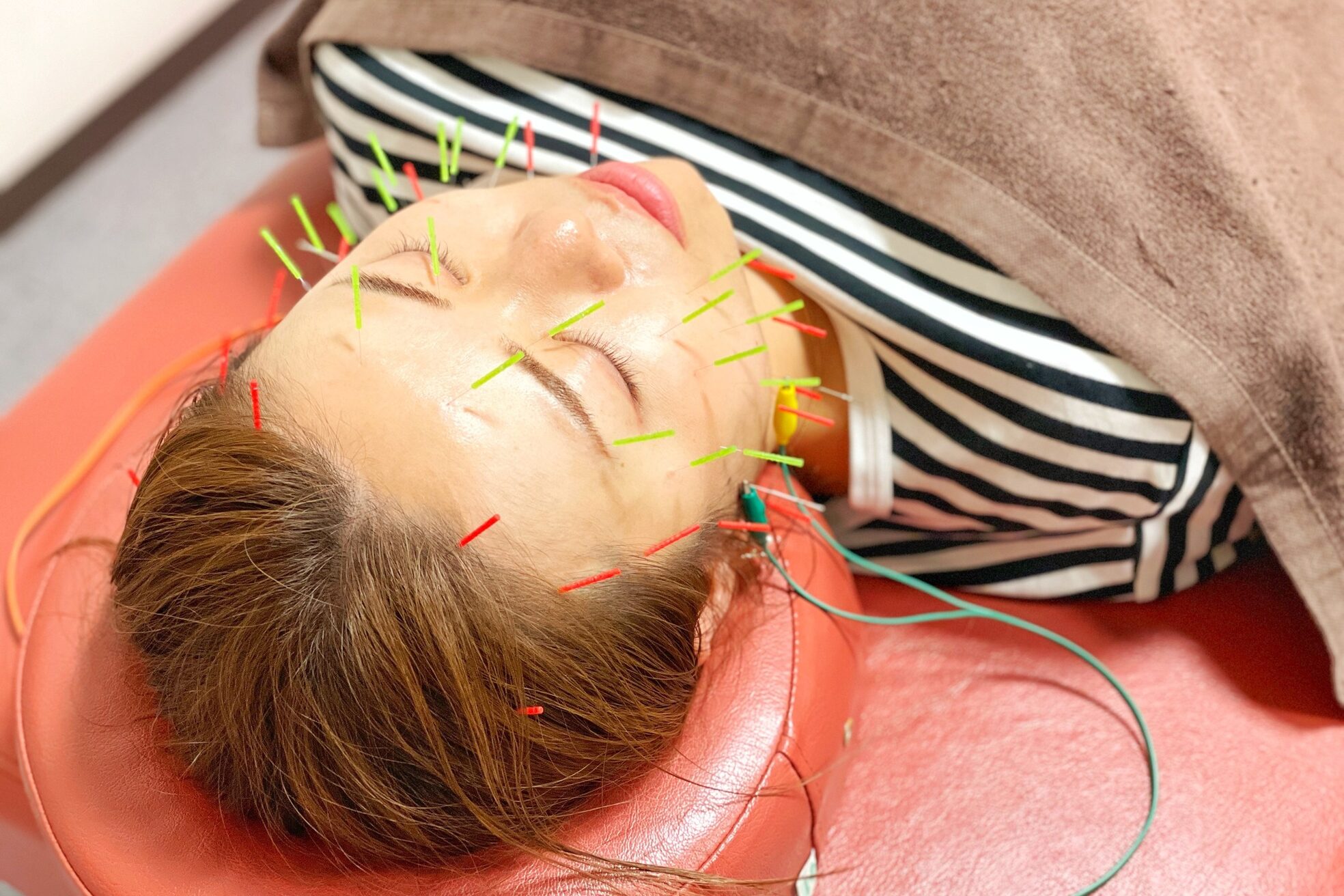 船橋はりきゅう整骨院5