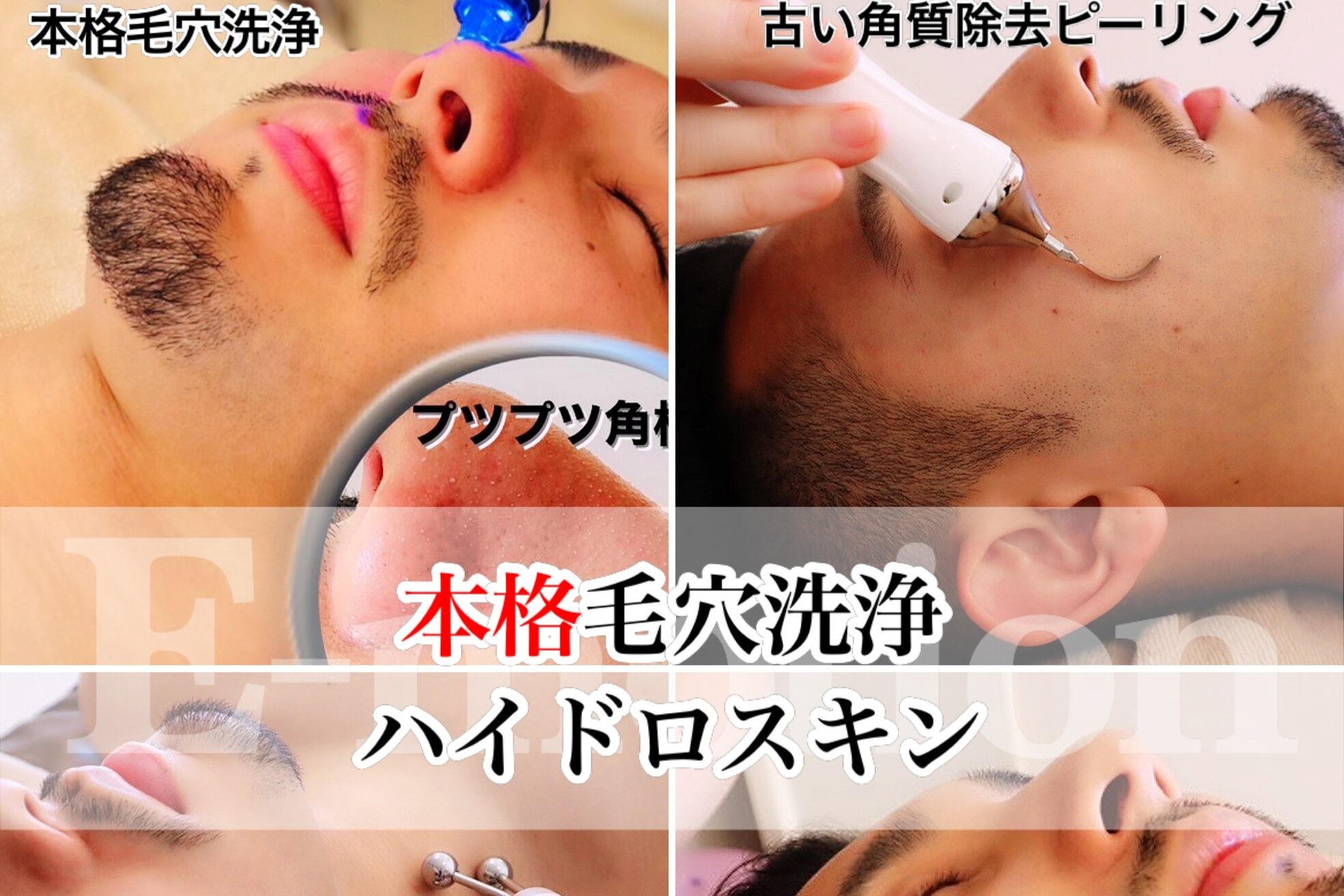 エモーションプラス(E-Motion plus)4