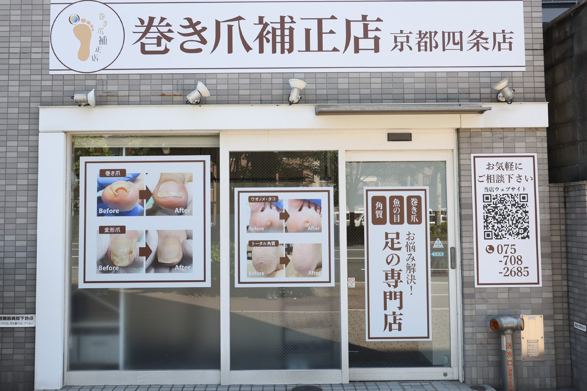 巻き爪補正店 京都四条店2