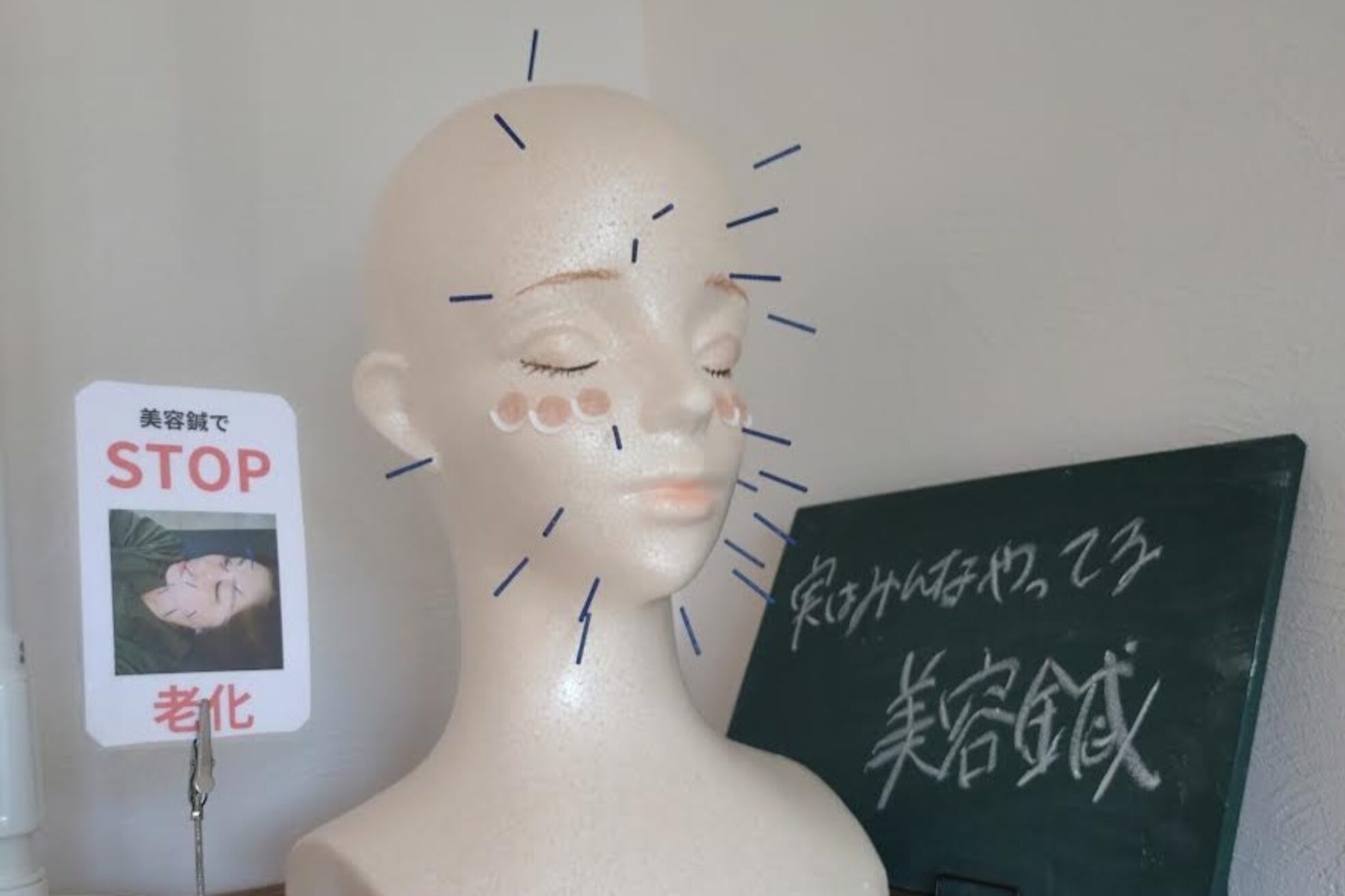 アンスリウム美容整体院 鍼灸院 接骨院4