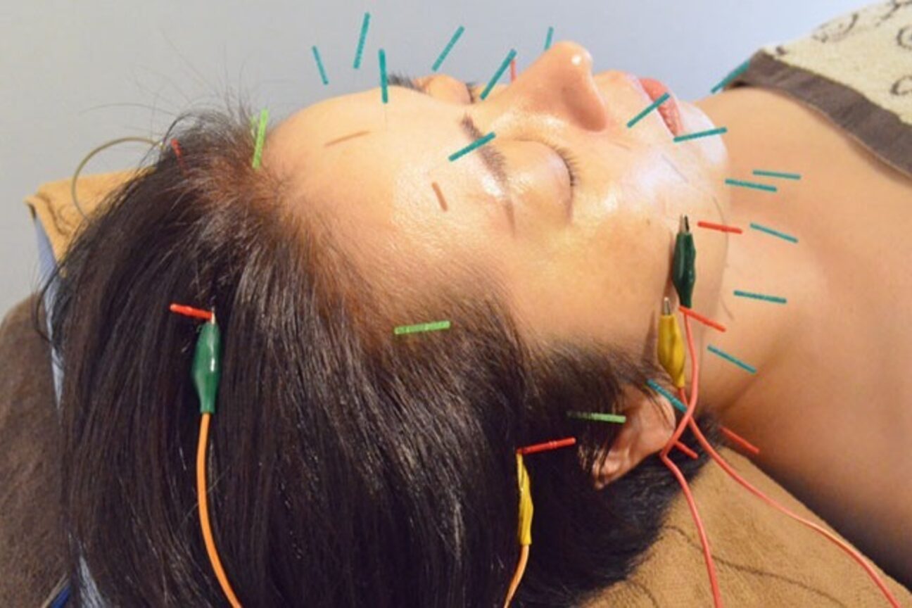 Nサンテ針灸治療院（Ｎ・サンテ針灸治療院）画像1