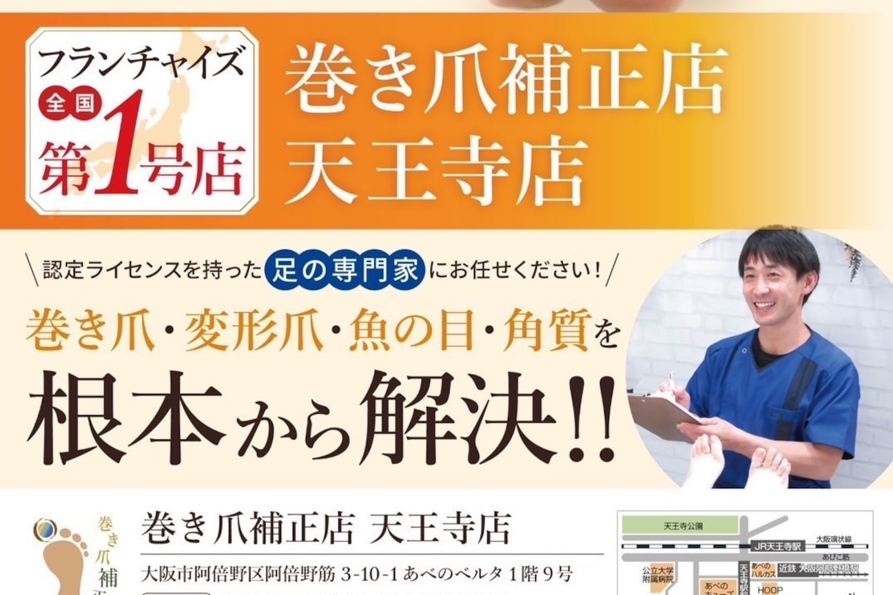 巻き爪補正店画像1