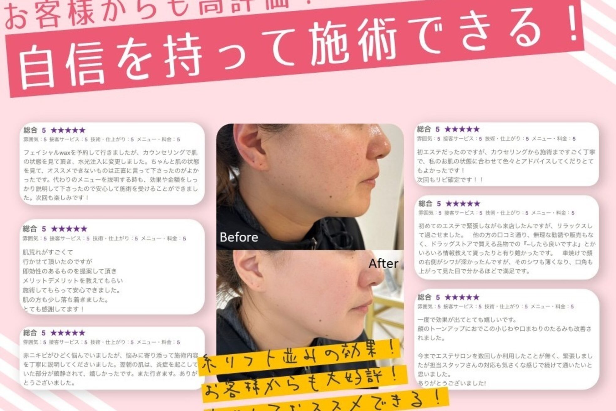 アイムエステ 表参道店(i'm este)3