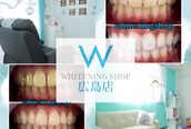 ホワイトニングショップ 広島店(WHITENING SHOP)