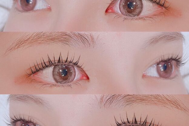 サンバイエム(#3/M)2