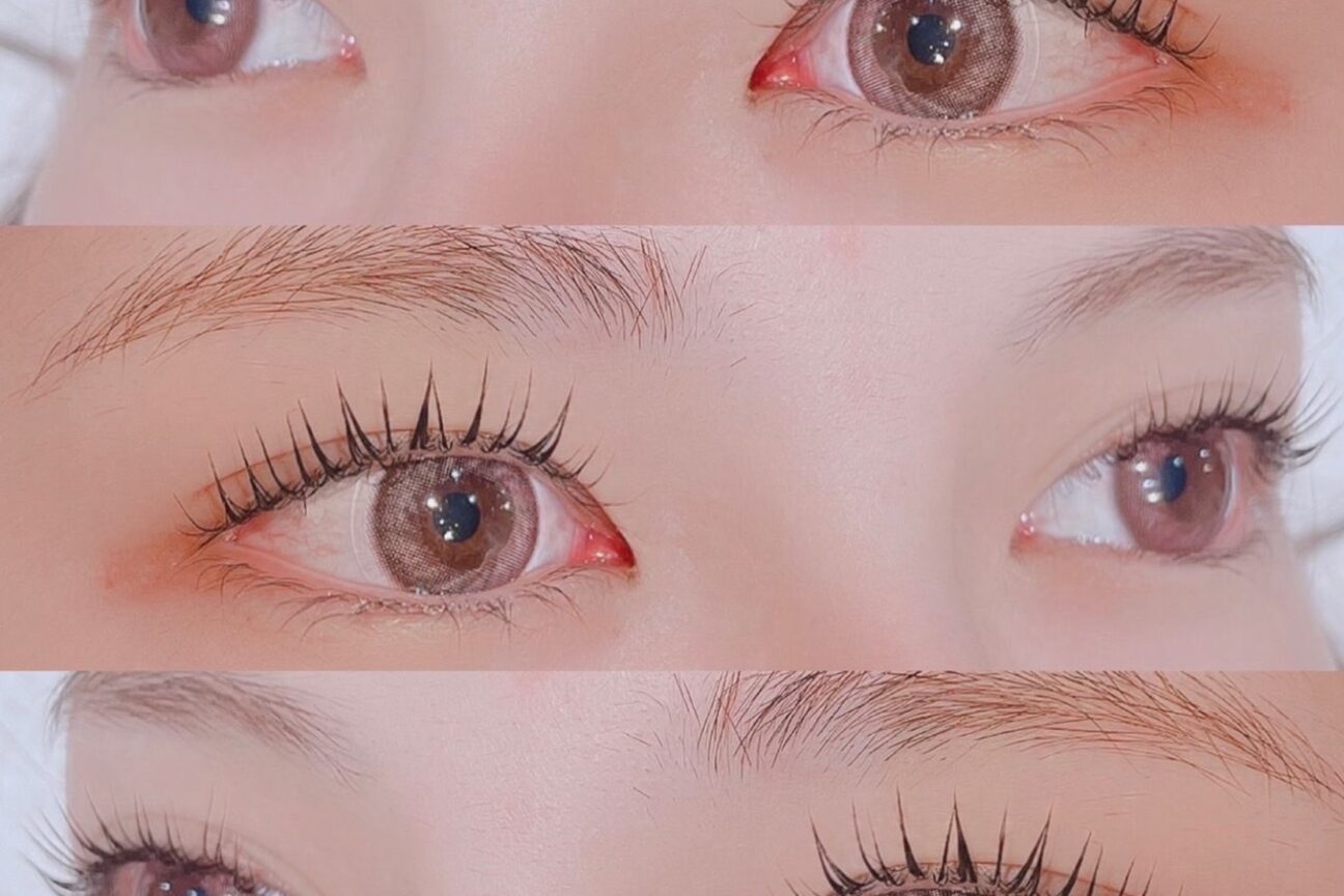 サンバイエム(#3/M)2