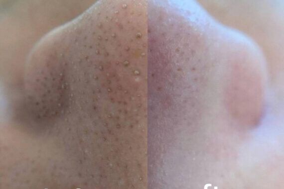 マベール(MABELLE)