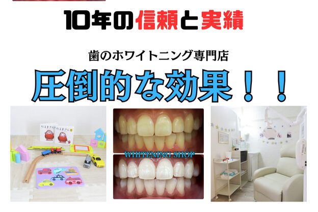 ホワイトニング ショップ 金沢店2